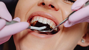 What You Need to Know About Safe Amalgam Removal and Heavy Metal Detox